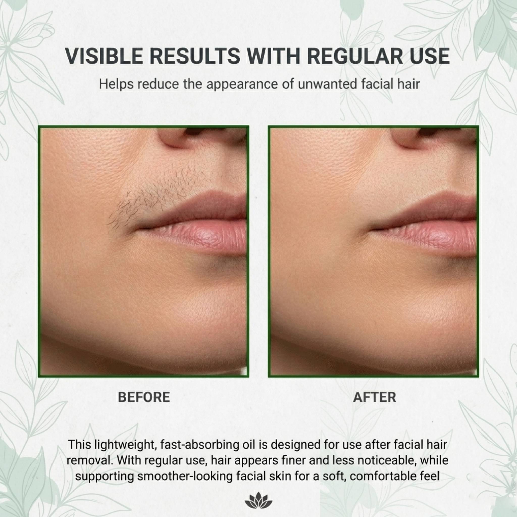 Hair Inhibitor Oil – Permanent Facial Hair Reduction